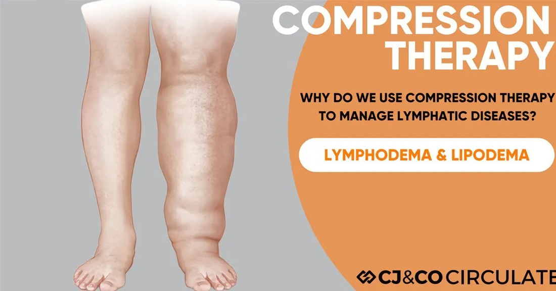 Transform Your Lymphatic Health with CJ&CO Circulate Compression Therapy
