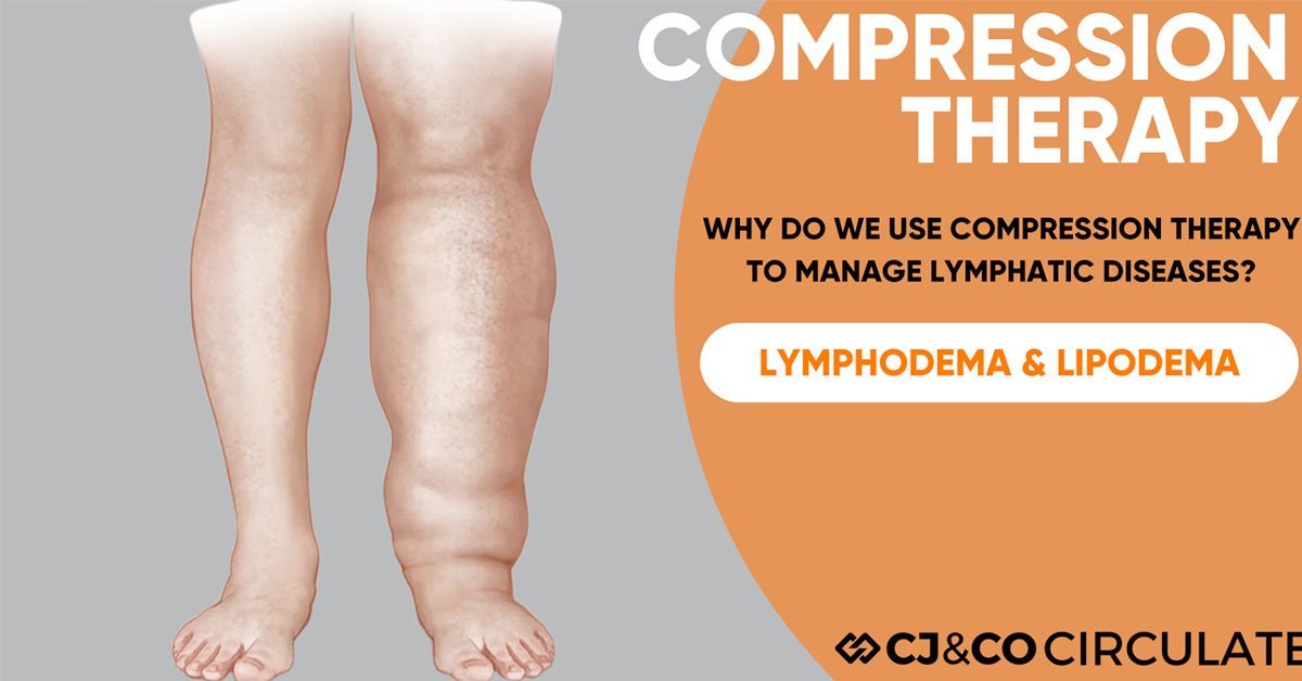 blog-compression-therapy-legs
