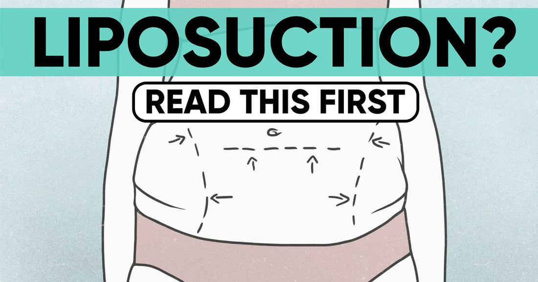 blog-liposuction