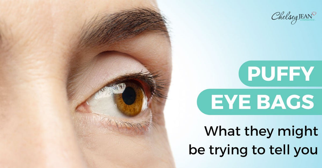 blog-puffy-eyes
